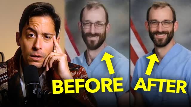 Did MSNBC Digitally Alter Alex Pretti's Face?